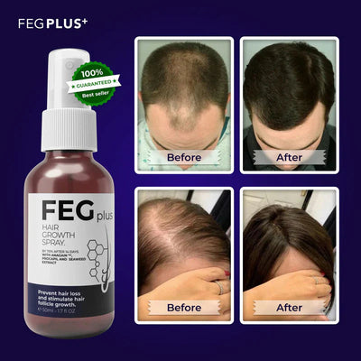 FEG PLUS HAIR GROWTH SPRAY